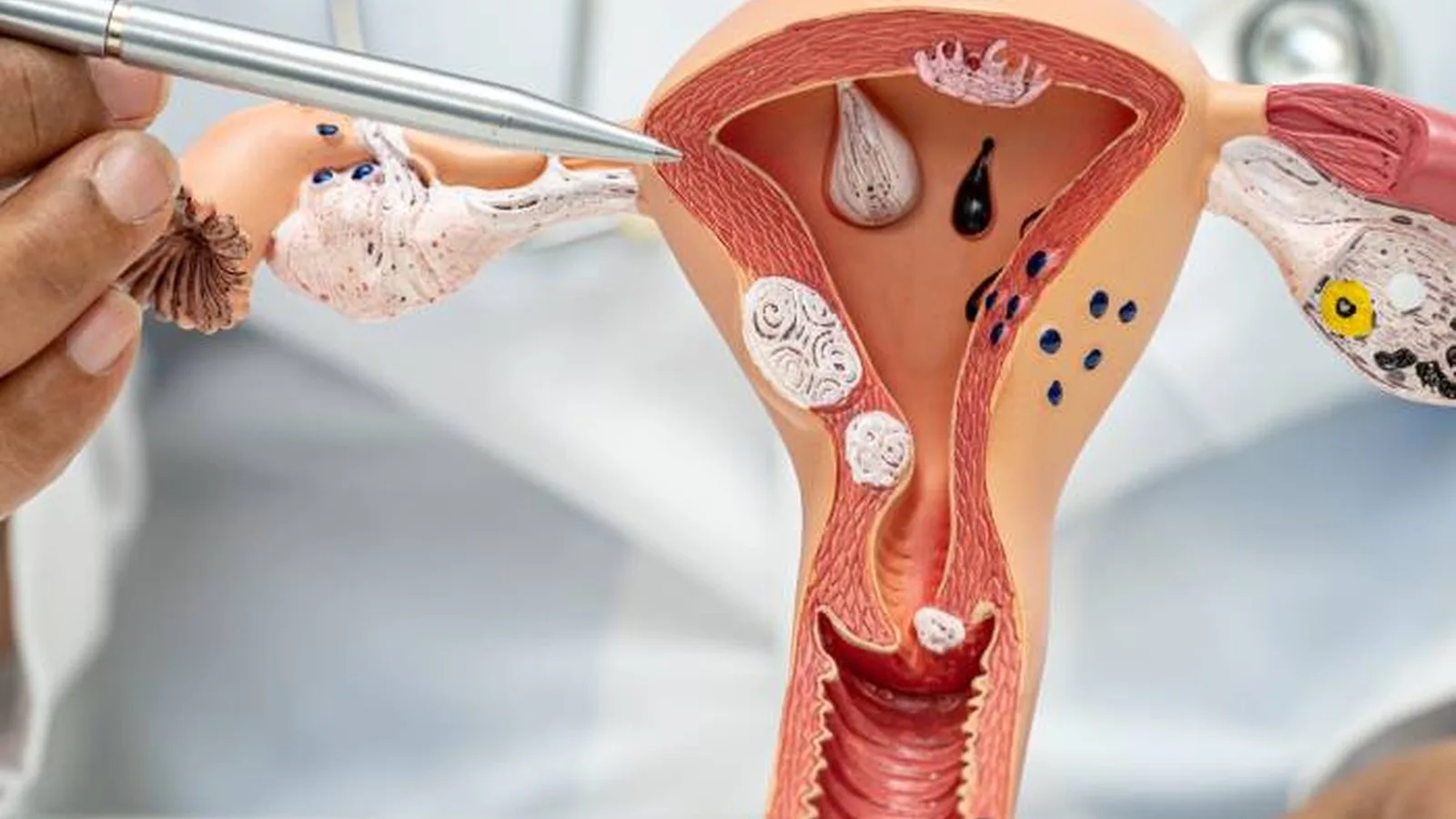 Ginecólogo especialista en fertilidad cerca de Centro de Monterrey
